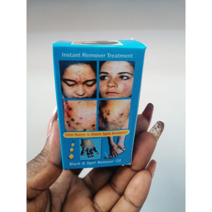🔥 LIMITED DEAL — Clarins Skin Burns & Black Spot Remover Cream | Heals Burns + Fades Dark Spots + Evens Skin Tone | KSh 1500