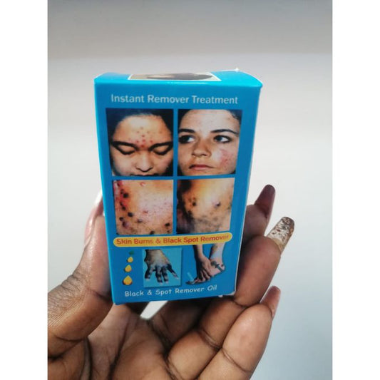 🔥 LIMITED DEAL — Clarins Skin Burns & Black Spot Remover Cream | Heals Burns + Fades Dark Spots + Evens Skin Tone | KSh 1500