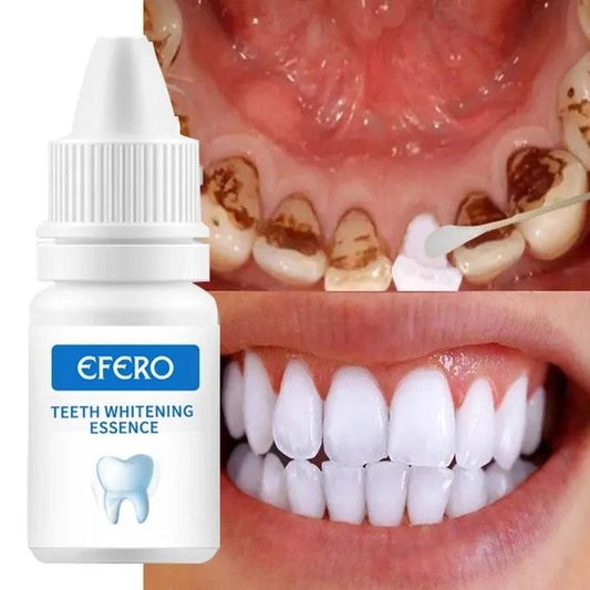 EFERO Teeth Whitening Essence – Effective Stain Remover for a Brighter Smile