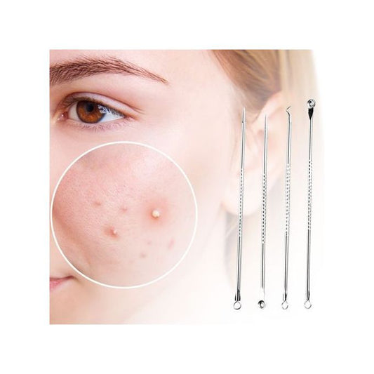 4pcs Blackhead Remover Kit – Stainless Steel Acne & Pimple Extractor Set