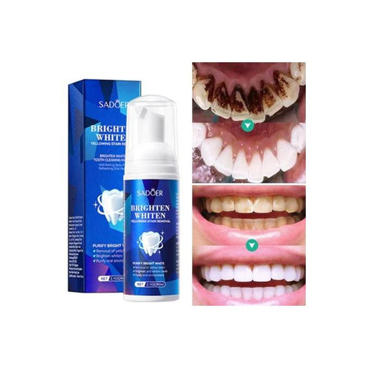 SADOER Teeth Whitening Teeth Whitener Liquid – Brown Stains Remover & Dental Mousse