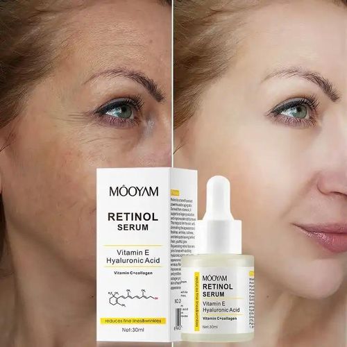 Retinol Face Serum Anti Aging Face Serum for Wrinkles,Lines, Dark Spots Retinol with Hyaluronic Acid_30ml