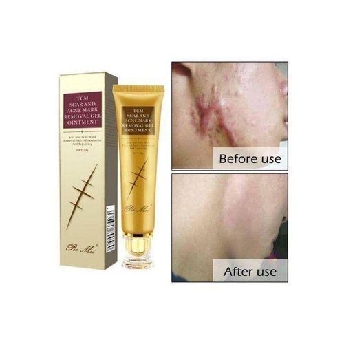 π₯ LIMITED DEAL β PeiMei TCM Lavender Scar & Stretch Mark Removal Oil | Fades Scars + Removes Stretch Marks + Repairs Skin | KSh 1,800