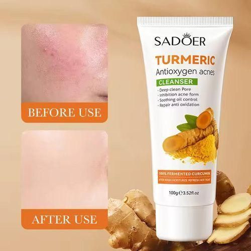 SADOER Turmeric Cleanser Anti Acnes Facial Cleanser, Tumeric Deep Cleansing Oil Control Cleanser