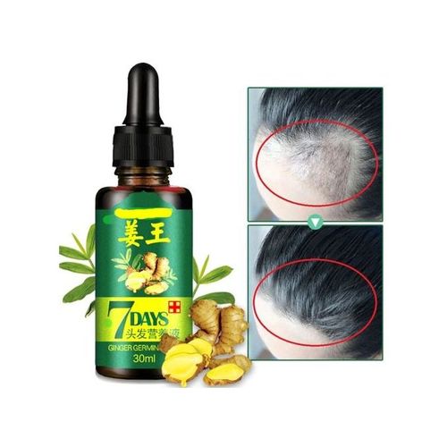 Gluta-Magic 7 Days Hair Tonic Ginger Germinal Regrowth Oil