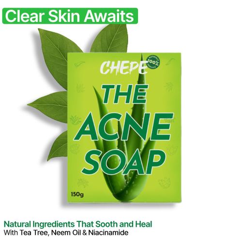 Chepe The Acne Soap