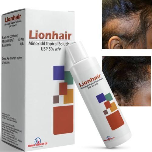 Minoxidil Lionhair Topical Solution For Alopecia,balding And Hair Thinning.