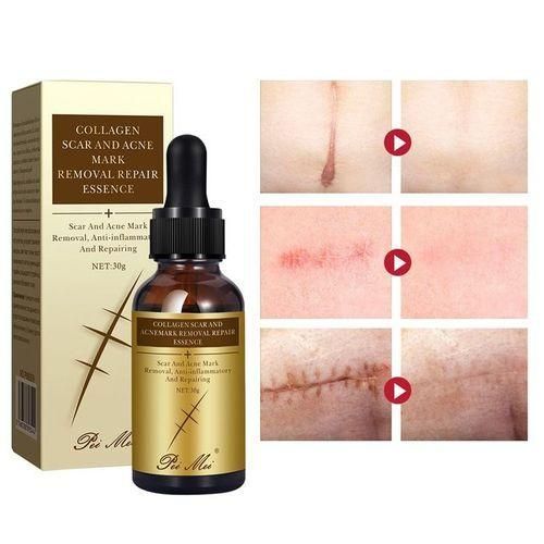 π₯ LIMITED DEAL β Pei Mei Collagen Scar & Acne Mark Removal Essence 30g | Fades Scars + Clears Acne Marks + Repairs Skin | KSh 1,500