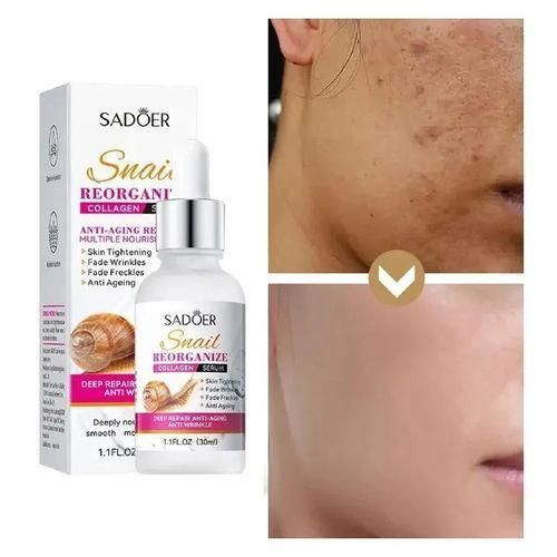 Snail Collagen Anti-aging Dark Spots Wrinkles