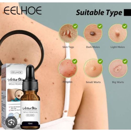 Eelhoe Mole Remover