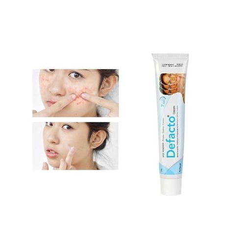 Defacto Anti Dark Spot, Pimples Removal Cream