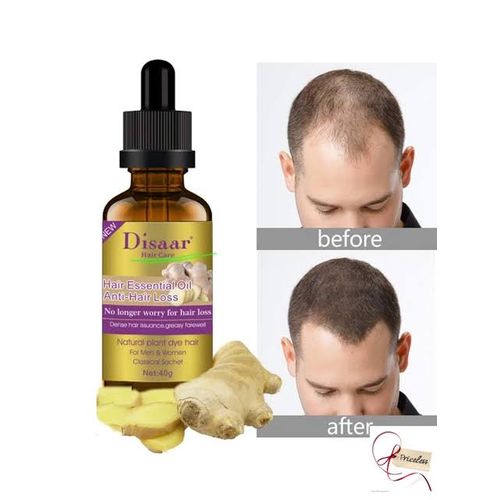 Disaar Hair Essential Oils Anti-Hair Loss With Ginger, 30ml