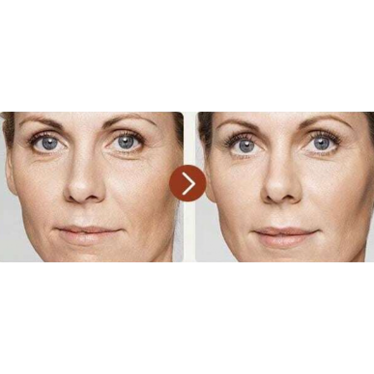 IRev Retinol Essence Toner