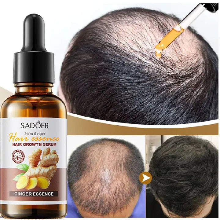 Sadoer Hair Growth Serum