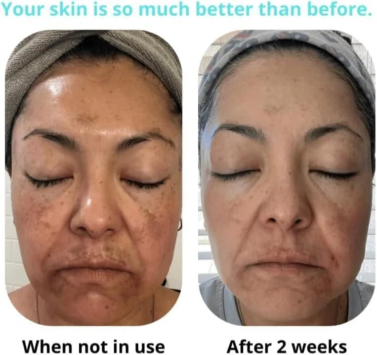 ORIGINAL Saam Renewal Face Cream..