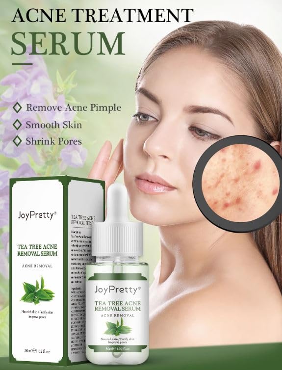 JoyPretty Tea Tree Acne Removal/ Treatment Serum (30 ml)