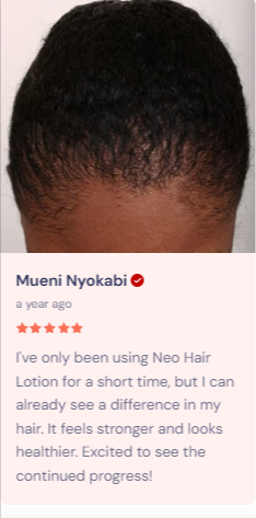 Neo Hair Lotion