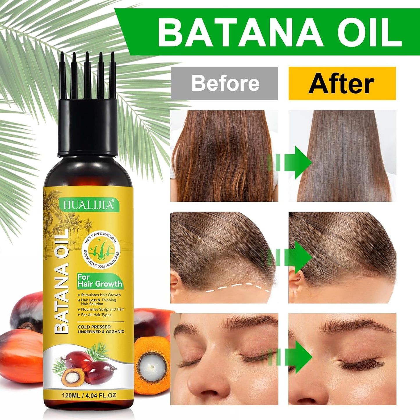 HUALIJIA Batana Oil for Hair Growth – 120ml