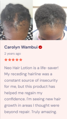 Neo Hair Lotion
