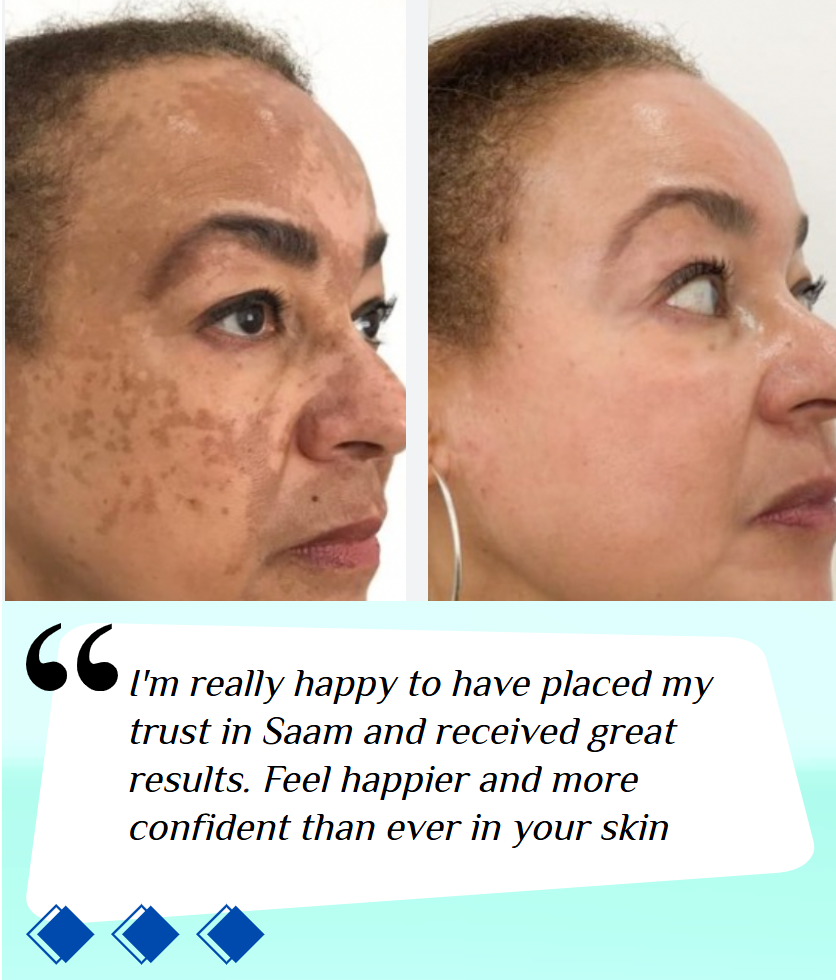 ORIGINAL Saam Renewal Face Cream
