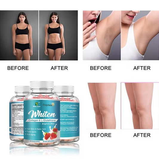 π₯ LIMITED DEAL β DAYNEE Glutathione Collagen Whitening Gummies | Brighter Skin + Clear Complexion + Healthy Hair | KSh 2999