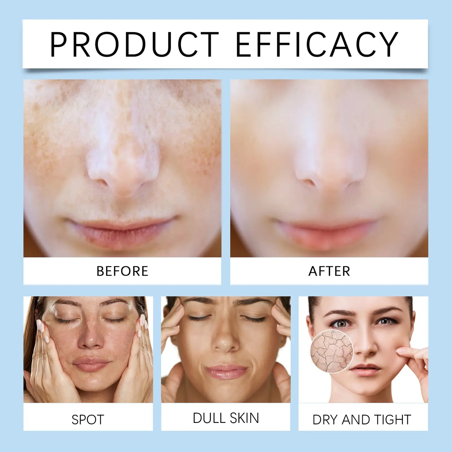 OUHOE Dark Spot Corrector Serum