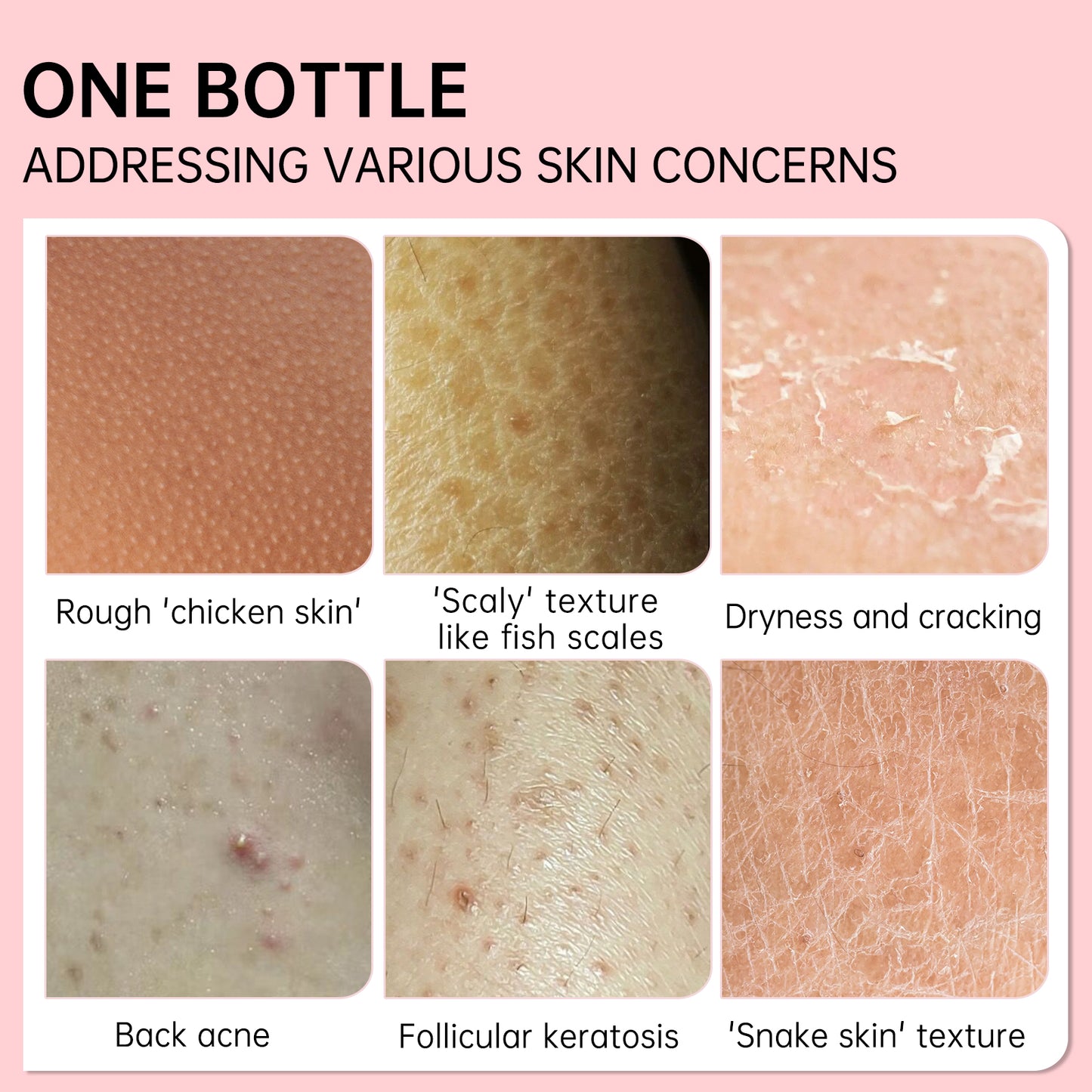JoyPretty KP Exfoliating Repair Cream