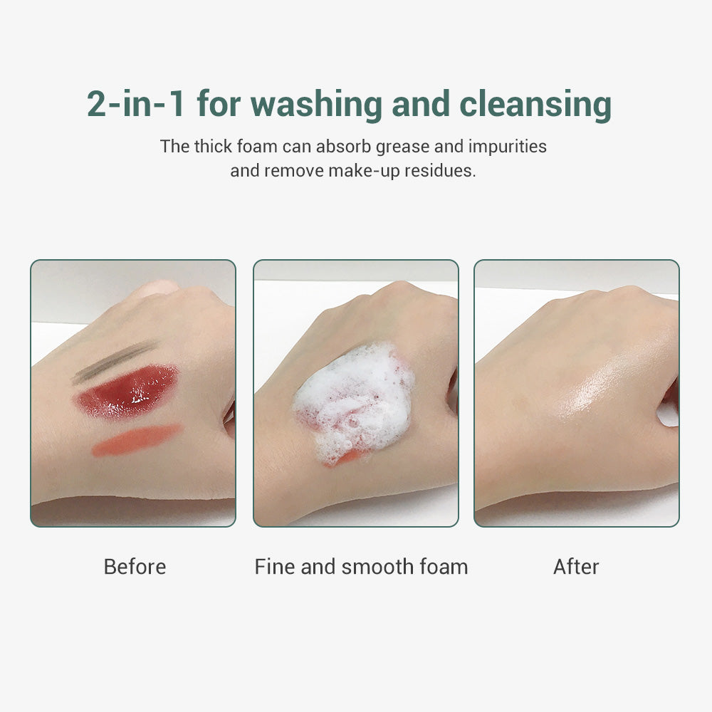 LANBENA Acne Treatment Facial Cleanser