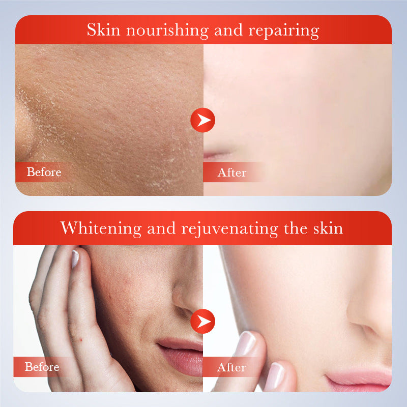 SADOER Kojic Acid Whiten Freckles Face Serum