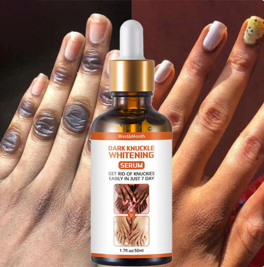 Skin Care Serum Vitamin C Brightening Whitening Skin Lifting Skin Care Serum Niainamide for Anti Aging Vitamin c Serum knucles, elbow, knees