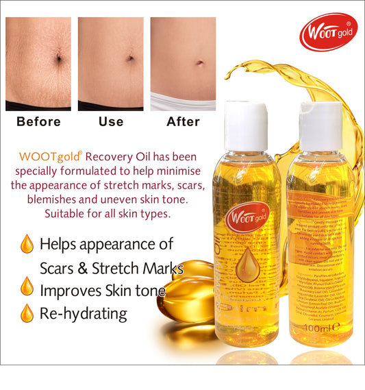 WOOT Gold Recovery Oil