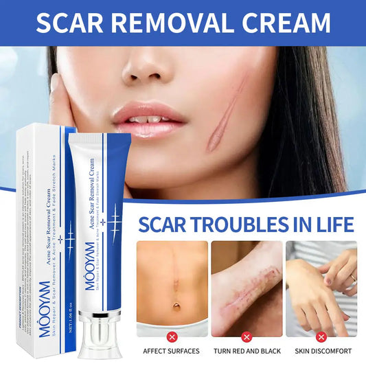 MOOYAM Strong Effective Acne Scar Removal Cream