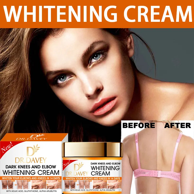 Dr. Davey Dark Knees and Elbows Whitening Cream (350ml)