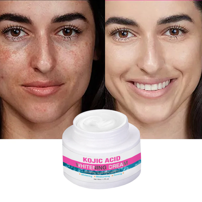 Kojic Acid Whitening Cream