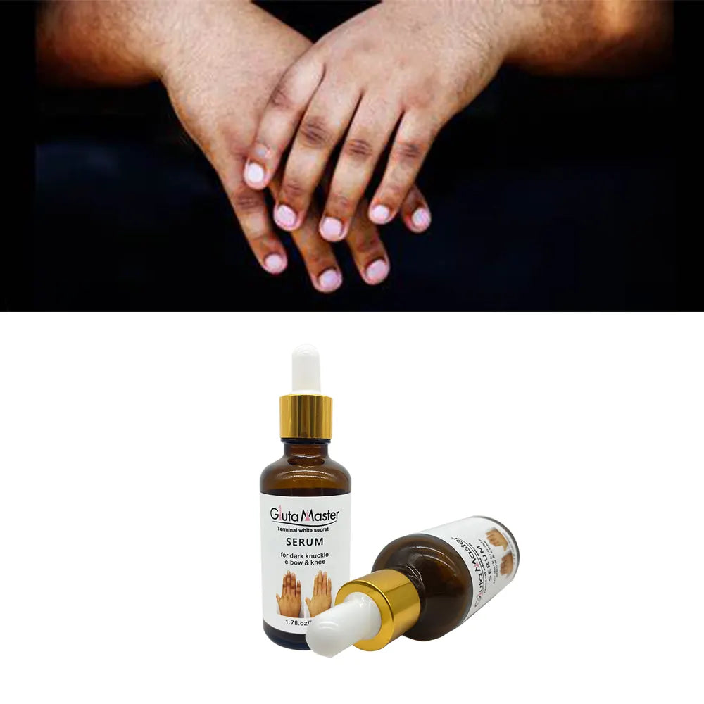 Gluta Master Serum for Dark Knuckles, Knees, and Elbows