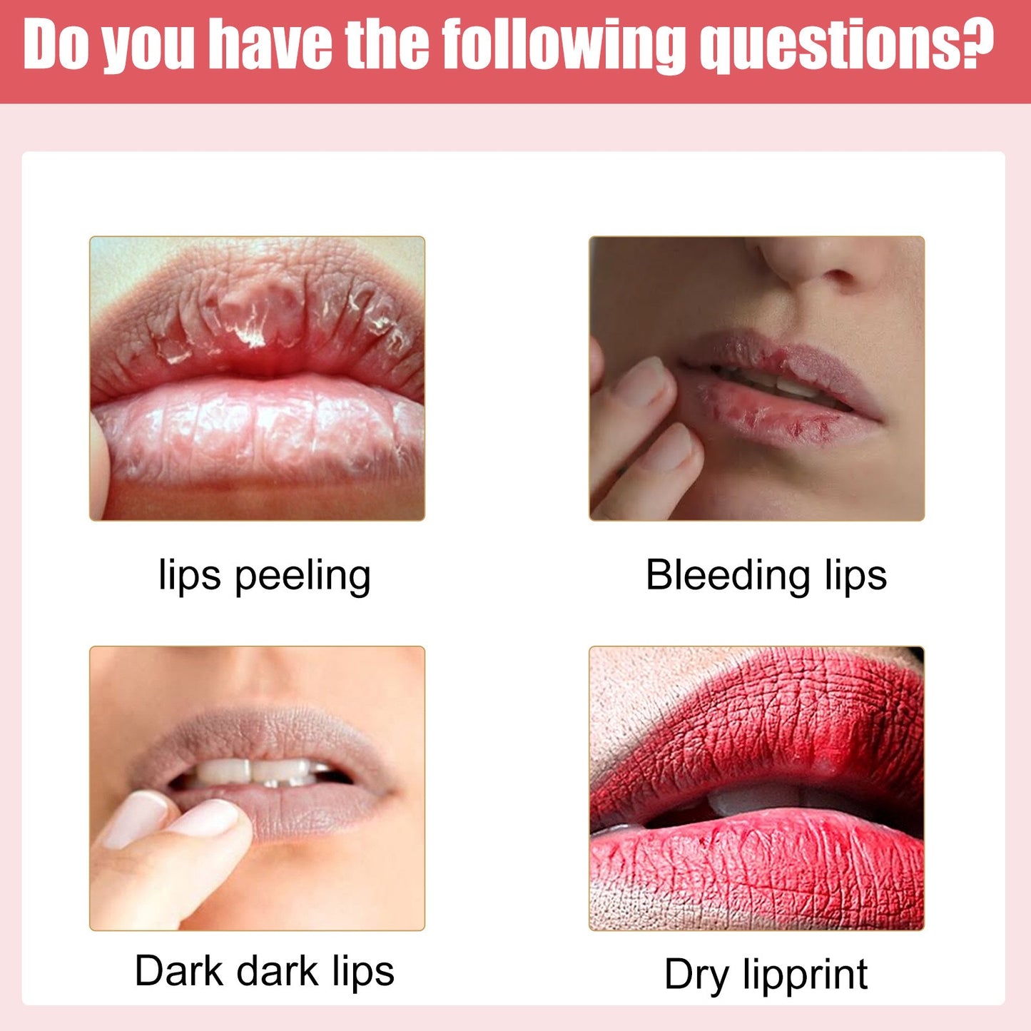 EELHOE Lip Lightening Cream (30 g)