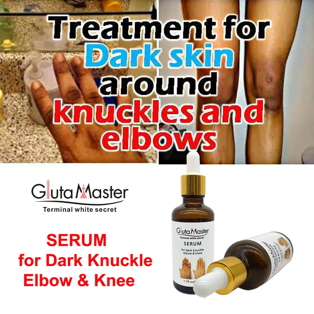 Gluta Master Serum for Dark Knuckles, Knees, and Elbows