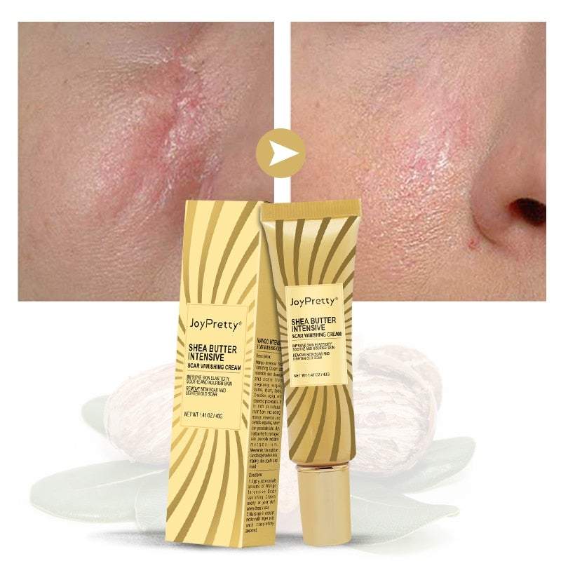 JoyPretty Shea Butter Intensive Scar Vanishing Cream (40 g)
