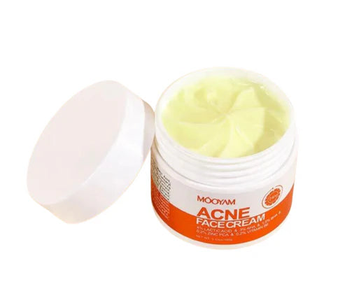 MOOYAM Acne Face Cream (30g)