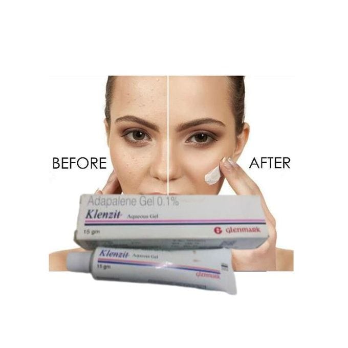 ACNES Klenzitt Gel Adapalene Acne Gel – Treat Acnes, Pimples
