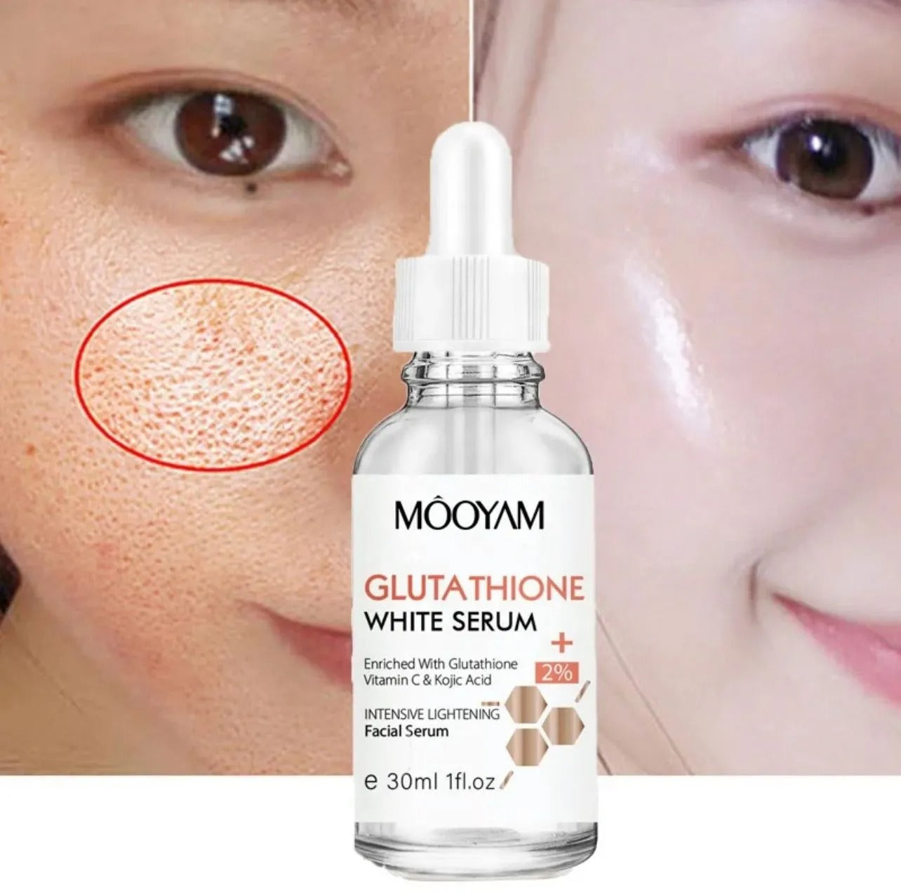 MOOYAM Glutathione Whitening Serum (30ml)  Starsam Naturals