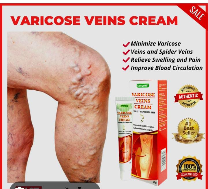 Kanyehb Varicose Vein Cream