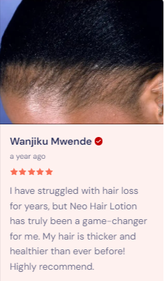 Neo Hair Lotion