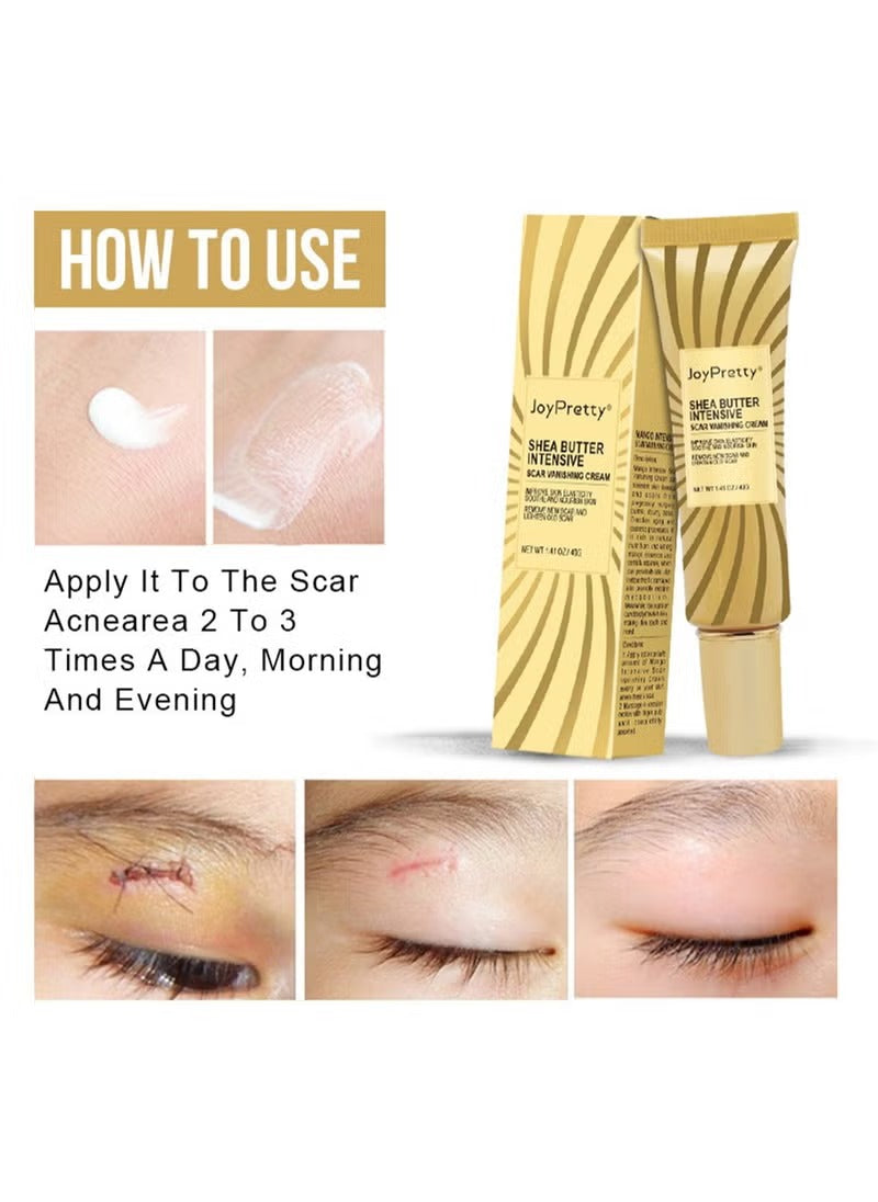 JoyPretty Shea Butter Intensive Scar Vanishing Cream (40 g)