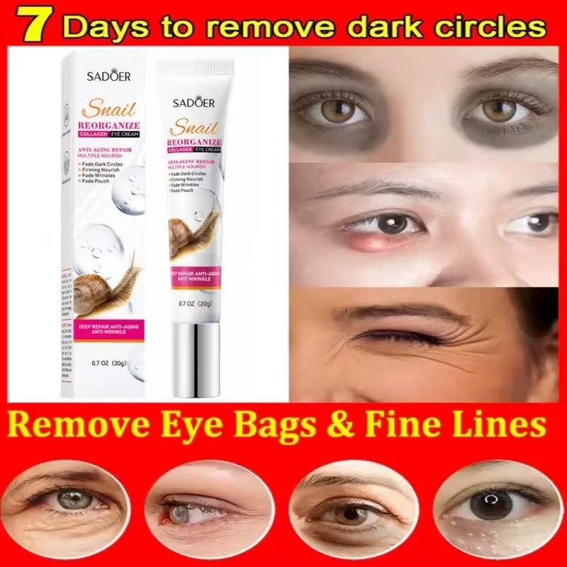 SADOER Snail Collagen Eye Cream (20g)