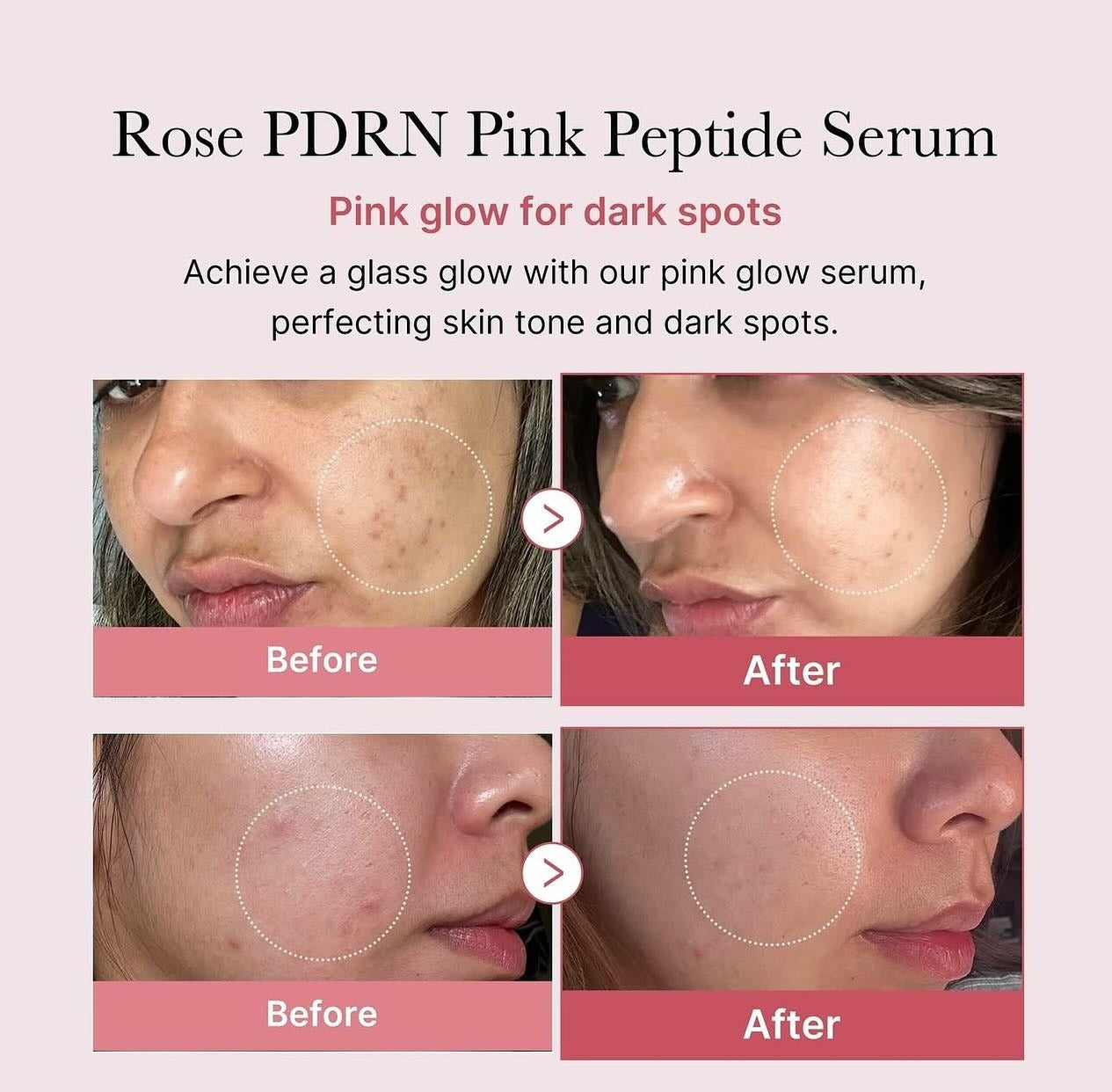 Medicube Rose PDRN Pink Peptide Serum
