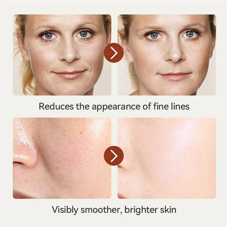 IREV Retinol Face Cream (50g)