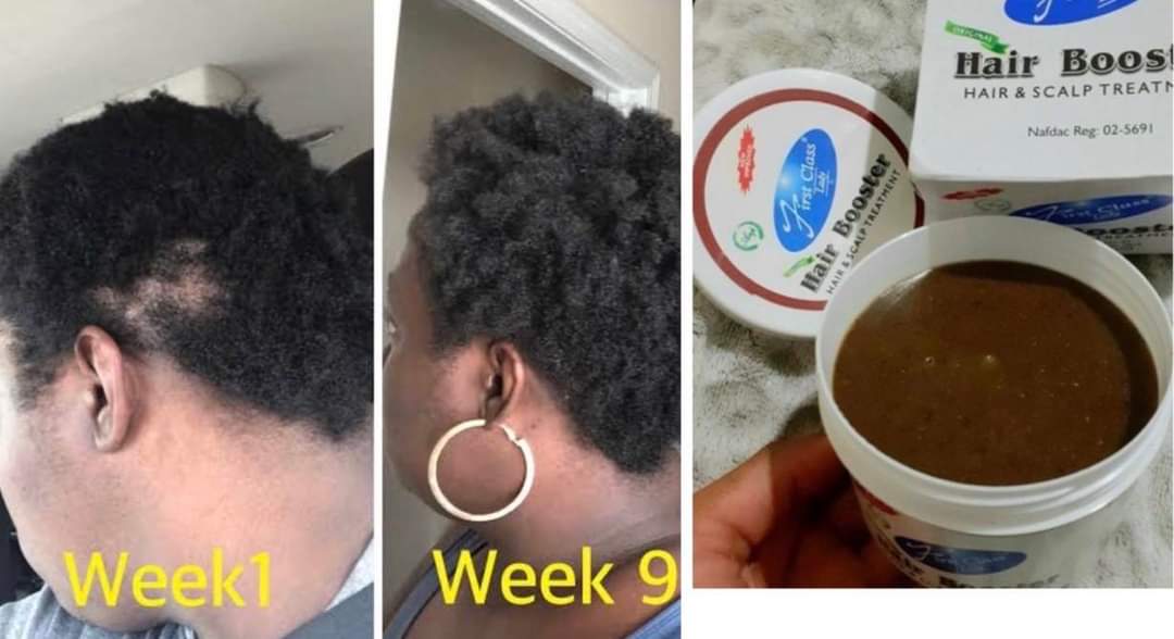 First Class Hair Booster 1