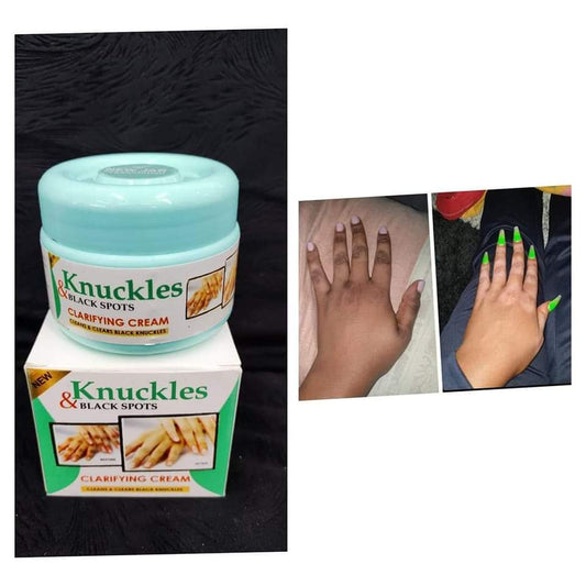 Skin Beauty Knuckles Elbow Knee Toes Black Spot Cream