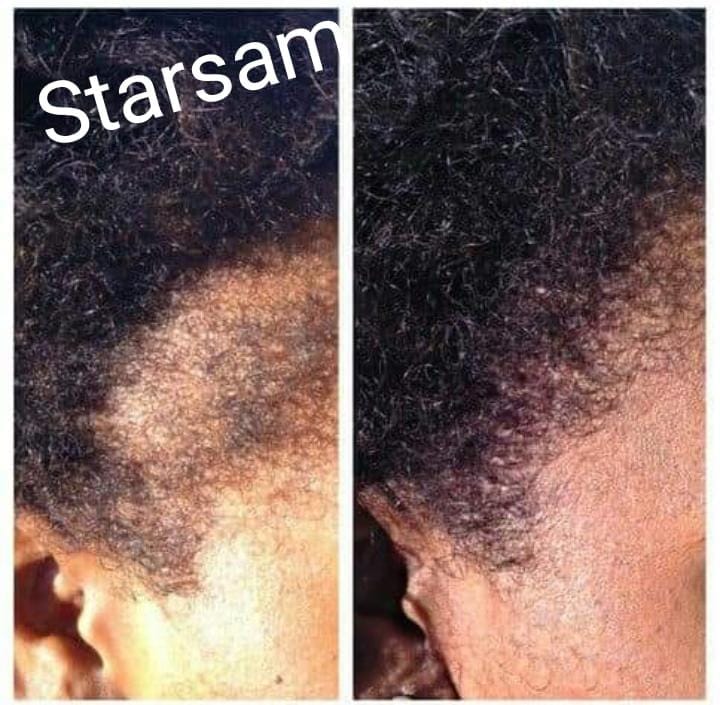 First Class Hair Booster 1